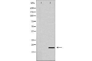 Western blot analysis of extracts of Raji , using BIK antibody. (BIK antibody  (N-Term))