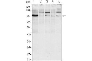 Western blot analysis using ERN1 mouse mAb against Raji (1), A431 (2), Jurkat (3), Hela(4) and HEK293 (5) cell lysate. (ERN1 antibody)