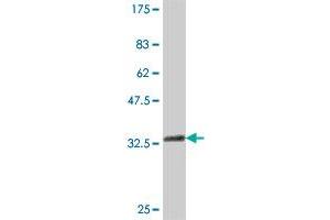 Western Blot detection against Immunogen (37 KDa) . (ELP4 antibody  (AA 101-199))