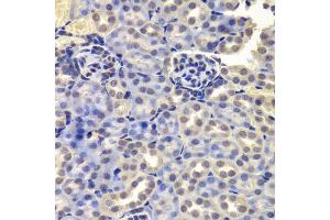 Immunohistochemistry of paraffin-embedded mouse kidney using LSM4 antibody. (LSM4 antibody  (AA 1-139))