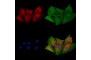ABIN6258226 and ABIN6273945 staining  cells by IF/ICC.
