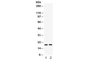 Western blot testing of 1) mouse ovary and 2) mouse HEPA lysate with IP10 antibody. (CXCL10 antibody  (AA 22-98))