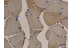 Immunohistochemistry (IHC) image for anti-Apolipoprotein B (APOB) (AA 2747-2913) antibody (ABIN7426895)