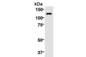 Western Blotting (WB) image for anti-Kinesin Family Member 11 (KIF11) (AA 1-1056), (N-Term) antibody (ABIN1449288) (KIF11 antibody  (N-Term))