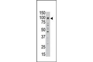 The anti-GED1 Ctr Antibody (ABIN390117 and ABIN2840625) is used in Western blot to detect GED1 in A549 lysate. (MAGED1 antibody  (AA 426-456))