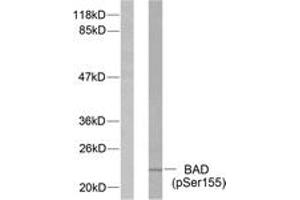 Western blot analysis of extracts from 293 cells treated with Forskolin, using BAD (Phospho-Ser155) Antibody. (BAD antibody  (pSer118))