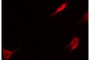 ABIN6275629 staining Hela by IF/ICC. (Thrombomodulin antibody  (C-Term))