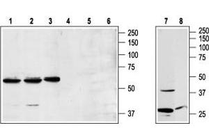 Neuropeptide Y Receptor Y1 (NPY1R) peptide
