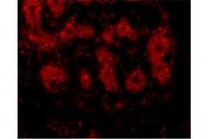 Immunofluorescence of TRIM5 alpha in human breast tissue with this product at 10 μg/ml. (TRIM5 antibody  (C-Term, Isoform alpha))