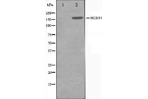 Western blot analysis of MED14 Antibody expression in Hela cells lysates. (MED14 antibody  (Internal Region))