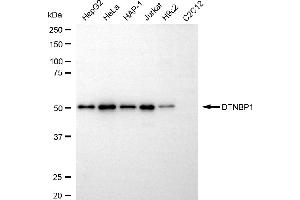 Western blotting analysis using DTNBP1 antibody (ABIN7798411).