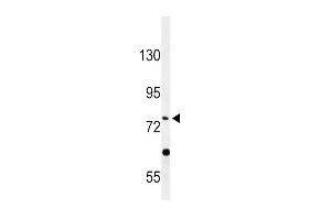 Western blot analysis of PLA2G6 Antibody in HepG2 cell line lysates (35ug/lane) (PLA2G6 antibody  (AA 551-580))