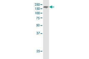 NPC1 monoclonal antibody (M02), clone 4H2. (NPC1 antibody  (AA 151-250))