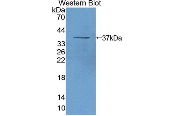 ALOX12B antibody  (AA 389-701)