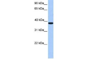 WB Suggested Anti-MEIS1 Antibody Titration:  0. (MEIS1 antibody  (C-Term))