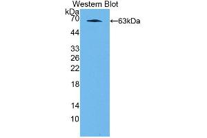 Figure. (NFIX antibody  (AA 13-298))
