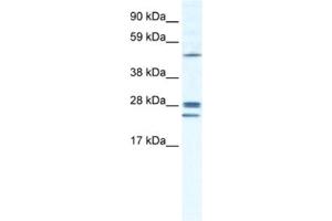 Western Blotting (WB) image for anti-Gap Junction Protein, beta 2, 26kDa (GJB2) antibody (ABIN2461384) (GJB2 antibody)