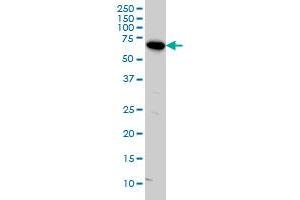 ARAF monoclonal antibody (M05), clone 3E2 Western Blot analysis of ARAF expression in HeLa . (ARAF antibody  (AA 151-250))