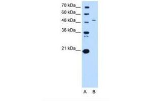 Image no. 2 for anti-serine Palmitoyltransferase, Long Chain Base Subunit 1 (SPTLC1) (AA 254-303) antibody (ABIN6738265) (SPTLC1 antibody  (AA 254-303))