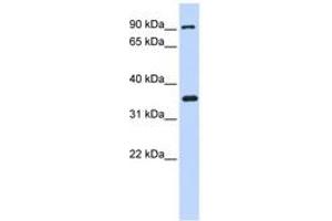 Image no. 1 for anti-Inhibitor of kappa Light Polypeptide Gene Enhancer in B-Cells, Kinase beta (IKBKB) (AA 215-264) antibody (ABIN6742299) (IKBKB antibody  (AA 215-264))