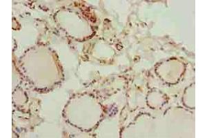 Immunohistochemistry of paraffin-embedded human thyroid tissue using ABIN7154238 at dilution of 1:100 (GLT1D1 antibody  (AA 17-152))