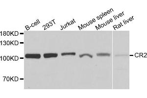 Western blot analysis of extracts of various cell lines, using CR2 antibody. (CD21 antibody)