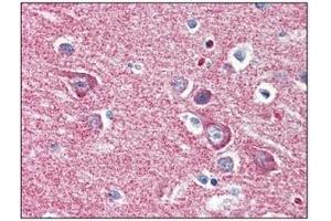 Immunohistochemistry (IHC) image for anti-Hexokinase 1 (HK1) (AA 1-917), (N-Term) antibody (ABIN317095) (Hexokinase 1 antibody  (N-Term))