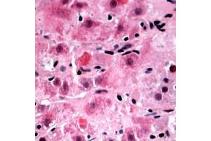 Immunohistochemical analysis of RPL39 staining in human liver formalin fixed paraffin embedded tissue section. (RPL39 antibody  (N-Term))