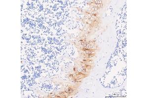 IHC analysis of COMP using anti-COMP antibody (ABIN6719297). (COMP antibody  (AA 505-757))