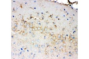 IHC-P: PMP70 antibody testing of rat brain tissue (PMP70 antibody  (C-Term))