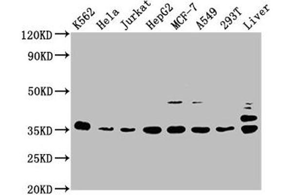PSMD14 antibody  (Regulatory Subunit 14)