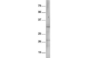Mouse spleen lysates probed with Anti-Bcl-2 (Ser70) Polyclonal Antibody, Unconjugated  at 1:5000 90min in 37˚C (Bcl-2 antibody  (pSer70))
