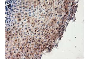 Immunohistochemical staining of paraffin-embedded Human tonsil using anti-ACSS2 mouse monoclonal antibody. (ACSS2 antibody)