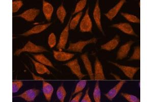 Immunofluorescence analysis of L929 cells using SMYD3 Polyclonal Antibody at dilution of 1:100. (SMYD3 antibody)