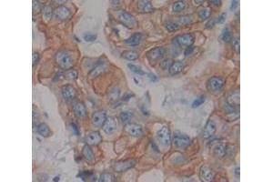 IHC-P analysis of Human Tissue, with DAB staining. (Neuregulin 1 antibody  (AA 20-242))