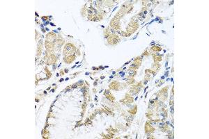 Immunohistochemistry of paraffin-embedded human stomach using IFNL3 antibody at dilution of 1:100 (40x lens). (IL28B antibody)