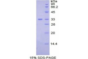 SDS-PAGE analysis of Human Ceruloplasmin Protein. (Ceruloplasmin Protein)