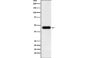 Western blot analysis of eIF4A1 expression in MCF7 cell lysate. (Recombinant EIF4A1 antibody)