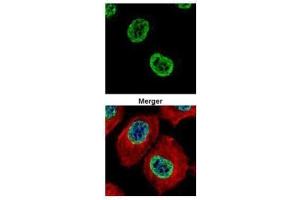 ICC/IF Image Confocal immunofluorescence analysis (Olympus FV10i) of paraformaldehyde-fixed A431, using Histone H2A. (H2AFZ antibody  (N-Term))