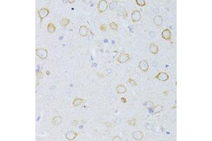 Immunohistochemistry of paraffin-embedded rat brain using CD63 antibody (ABIN5974980) at dilution of 1/100 (40x lens). (CD63 antibody)