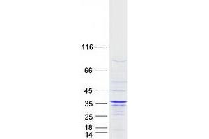 Western Blotting (WB) image for Intraflagellar Transport 43 Homolog (IFT43) (Transcript Variant 1) protein (Myc-DYKDDDDK Tag) (ABIN2714061)