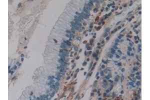 Immunohistochemistry (IHC) image for anti-Coagulation Factor XIII, A1 Polypeptide (F13A1) (AA 107-345) antibody (ABIN7433159)