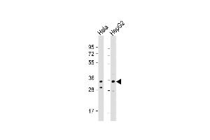 All lanes : Anti-I Antibody (C-term) at 1:1000 dilution Lane 1: Hela whole cell lysate Lane 2: HepG2 whole cell lysate Lysates/proteins at 20 μg per lane. (IMP4 antibody  (C-Term))