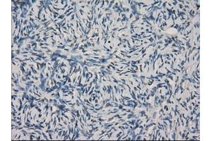 Immunohistochemical staining of paraffin-embedded colon tissue using anti-FCGR2A mouse monoclonal antibody. (FCGR2A antibody)