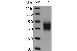 Western Blotting (WB) image for CD16 (CD16) (Active) protein (His tag) (ABIN7194703) (CD16 Protein (CD16) (His tag))