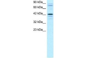 Human Jurkat; WB Suggested Anti-SOX18 Antibody Titration: 2. (SOX18 antibody  (Middle Region))