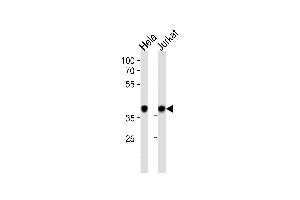 Western blot analysis in Hela,Jurkat cell line lysates (35ug/lane). (NPM1 antibody  (C-Term))