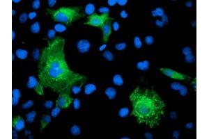 Anti-KATNB1 mouse monoclonal antibody (ABIN2455206) immunofluorescent staining of COS7 cells transiently transfected by pCMV6-ENTRY KATNB1 (RC201852). (KATNB1 antibody)