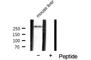 Western blot analysis of mTOR phosphorylation expression in mouse liver tissue lysates,The lane on the right is treated with the antigen-specific peptide. (MTOR antibody  (pSer2448))