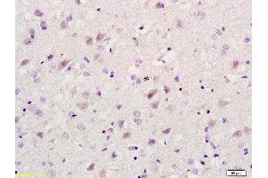 Formalin-fixed and paraffin embedded rat brain labeled with Rabbit Anti RBBP5 Polyclonal Antibody, Unconjugated  at 1:200 followed by conjugation to the secondary antibody and DAB staining